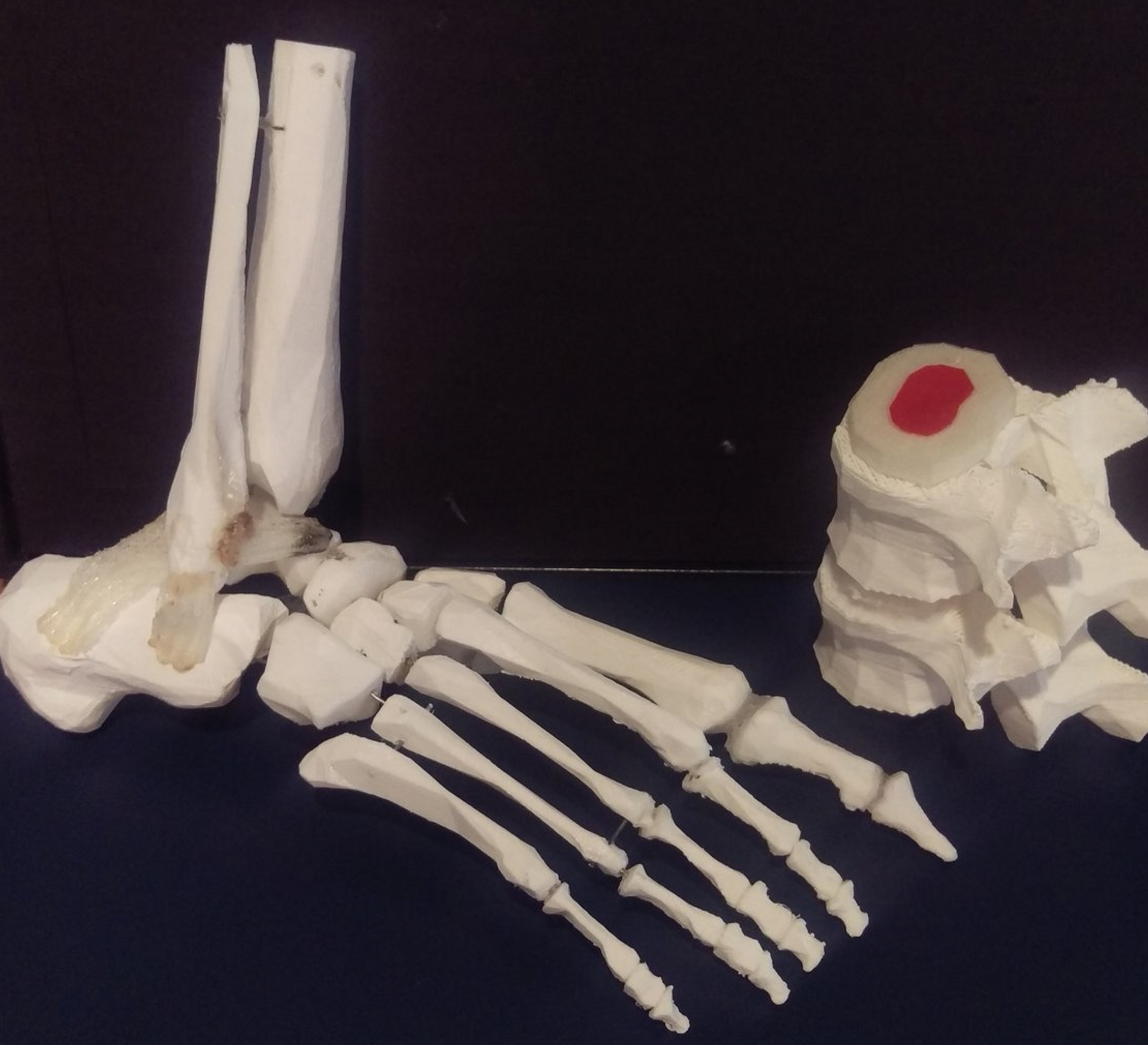 Custom 3D Printed Orthopedic Anatomy.